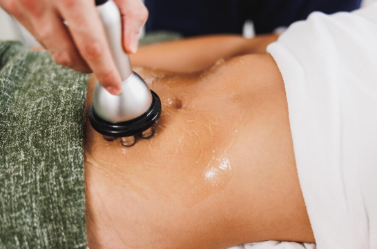 The Acoustic Physics and Cellular Dynamics of Ultrasonic Cavitation in Aesthetic Body Remodeling